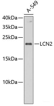 Confocal immunofluorescence analysis of U2OS cells using OCIAD1 Polyclonal Antibody at dilution of  1:100. Blue: DAPI for nuclear staining.