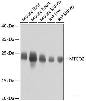 Immunofluorescence analysis of H9C2 cells using OTUB1 Polyclonal Antibody at dilution of  1:100. Blue: DAPI for nuclear staining.