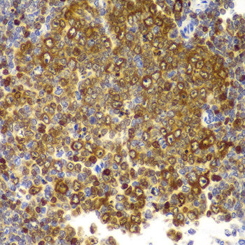 Immunohistochemistry of paraffin-embedded Mouse heart using CAPN1 Polyclonal Antibody at dilution of  1:100 (40x lens).