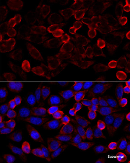 Immunohistochemistry of paraffin-embedded Rat liver using TRIM15 Polyclonal Antibody at dilution of  1:100 (40x lens).