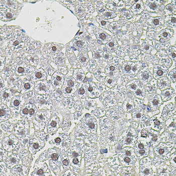 Immunofluorescence analysis of C6 cells using KRAS Polyclonal Antibody at dilution of  1:100. Blue: DAPI for nuclear staining.