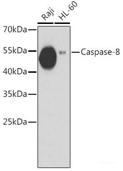 Immunohistochemistry of paraffin-embedded Rat heart using FHIT Polyclonal Antibody at dilution of  1:100 (40x lens).