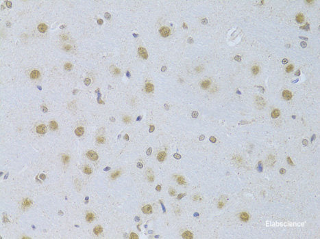 Immunofluorescence analysis of HeLa cells using KLRK1 Polyclonal Antibody at dilution of  1:100. Blue: DAPI for nuclear staining.