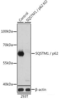 Immunohistochemistry of paraffin-embedded Mouse spleen using PD-1 Polyclonal Antibody at dilution of  1:200 (40x lens).