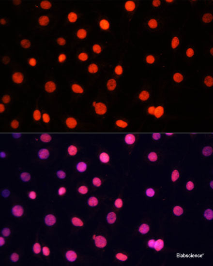 Immunohistochemistry of paraffin-embedded Rat lung using IGF1 Polyclonal Antibody at dilution of  1:100 (40x lens).
