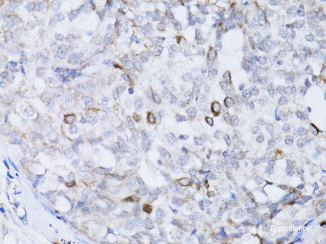 Immunohistochemistry of paraffin-embedded Mouse lung using FGF10 Polyclonal Antibody at dilution of  1:100 (40x lens).