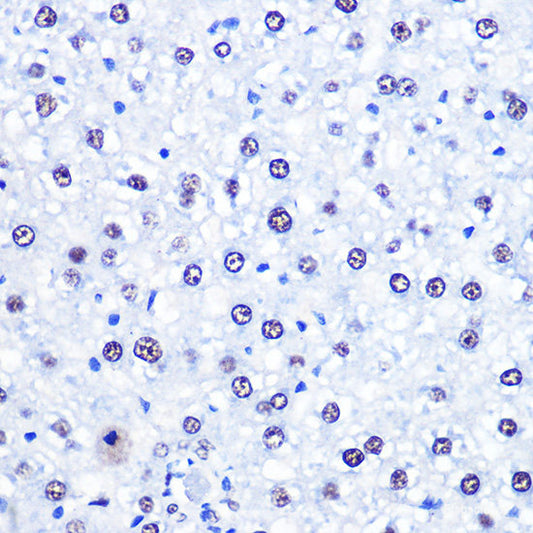 Western blot analysis of extracts of Rat brain using ZSCAN4 Polyclonal Antibody at dilution of 1:3000.