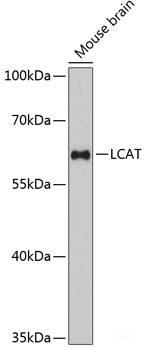 Immunofluorescence analysis of U2OS cells using PMEPA1 Polyclonal Antibody at dilution of  1:100. Blue: DAPI for nuclear staining.