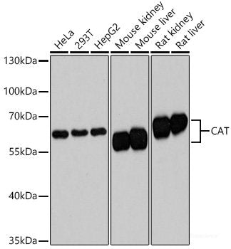 Confocal immunofluorescence analysis of HeLa cells using RRBP1 Polyclonal Antibody at dilution of  1:100. Blue: DAPI for nuclear staining.