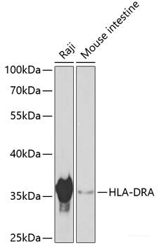 Immunohistochemistry of paraffin-embedded Human colon using GIPC2 Polyclonal Antibody at dilution of  1:100 (40x lens).