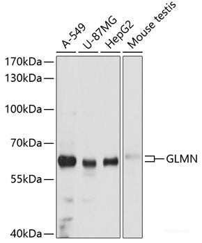 Immunofluorescence analysis of NIH-3T3 cells using GPC3 Polyclonal Antibody at dilution of  1:100 (40x lens). Blue: DAPI for nuclear staining.