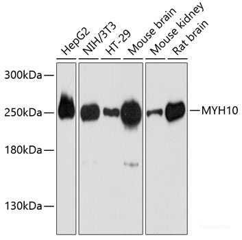 Immunohistochemistry of paraffin-embedded Human placenta using MEF2C Polyclonal Antibody at dilution of  1:100 (40x lens).