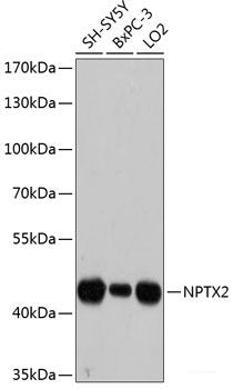 Western blot analysis of extracts of Mouse liver using ACP1 Polyclonal Antibody at dilution of 1:1000.