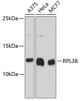 Immunofluorescence analysis of HeLa cells using ALAD Polyclonal Antibody at dilution of  1:100. Blue: DAPI for nuclear staining.