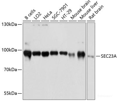 Immunohistochemistry of paraffin-embedded Rat testis using HEXA Polyclonal Antibody at dilution of  1:100 (40x lens).