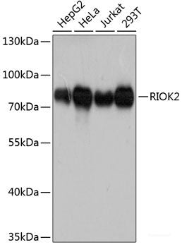 Immunohistochemistry of paraffin-embedded Rat lung using NTF3 Polyclonal Antibody at dilution of  1:100 (40x lens).