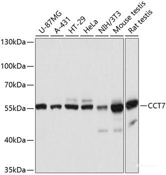 Immunohistochemistry of paraffin-embedded Rat lung using PI3 Polyclonal Antibody at dilution of  1:100 (40x lens).