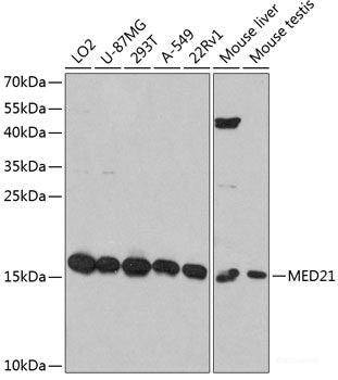 Immunohistochemistry of paraffin-embedded Rat testis using VAMP2 Polyclonal Antibody at dilution of  1:100 (40x lens).