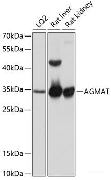 Immunohistochemistry of paraffin-embedded Mouse liver using TGFA Polyclonal Antibody 