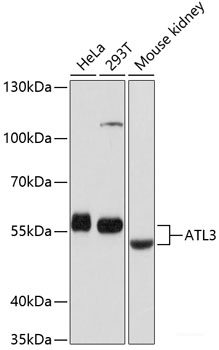 Immunohistochemistry of paraffin-embedded Mouse liver using TOP1 Polyclonal Antibody at dilution of  1:100 (40x lens).
