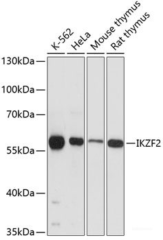 Immunohistochemistry of paraffin-embedded Rat brain using WISP2 Polyclonal Antibody at dilution of  1:100 (40x lens).