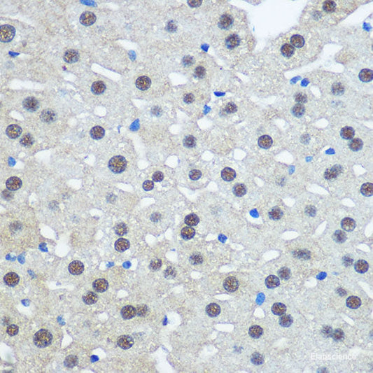 Immunofluorescence analysis of C6 cells using IRAK1 Polyclonal Antibody at dilution of  1:100. Blue: DAPI for nuclear staining.