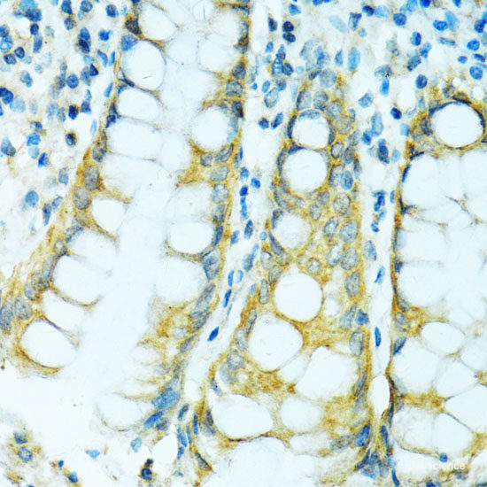 Immunohistochemistry of paraffin-embedded Rat ovary using ZNF416 Polyclonal Antibody at dilution of  1:100 (40x lens).