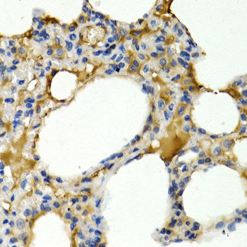 Immunofluorescence analysis of C6 cells using E2F1 Polyclonal Antibody at dilution of  1:100 (40x lens). Blue: DAPI for nuclear staining.