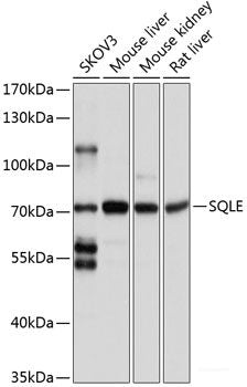 Immunohistochemistry of paraffin-embedded Mouse brain using CDK10 Polyclonal Antibody at dilution of  1:100 (40x lens).