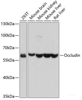 Immunofluorescence analysis of Rat brain using GRIN2B Polyclonal Antibody at dilution of  1:100. Blue: DAPI for nuclear staining.