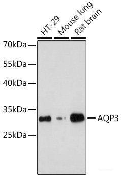 Immunohistochemistry of paraffin-embedded Mouse liver fibrosis using FAM160B2 Polyclonal Antibody at dilution of  1:200 (40x lens).