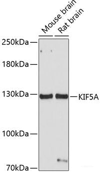 Immunohistochemistry of paraffin-embedded Rat heart using PRPH Polyclonal Antibody at dilution of  1:100 (40x lens).