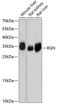 Immunofluorescence analysis of C6 cells using SLC20A1 Polyclonal Antibody at dilution of  1:100. Blue: DAPI for nuclear staining.