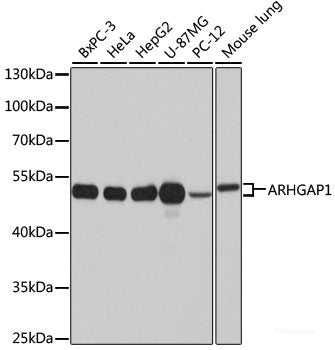 Immunohistochemistry of paraffin-embedded Human stomach using USH1C Polyclonal Antibody at dilution of  1:100 (40x lens).