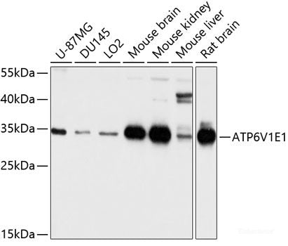 Immunohistochemistry of paraffin-embedded Human lung cancer using BCAS2 Polyclonal Antibody at dilution of  1:100 (40x lens).