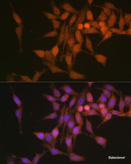 Immunofluorescence analysis of U2OS cells using PCDHA6 Polyclonal Antibody at dilution of  1:100. Blue: DAPI for nuclear staining.