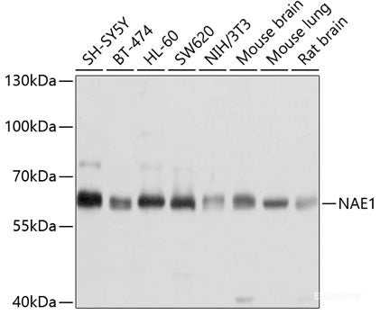 Immunohistochemistry of paraffin-embedded Human prostate using FMR1NB Polyclonal Antibody at dilution of  1:100 (40x lens).