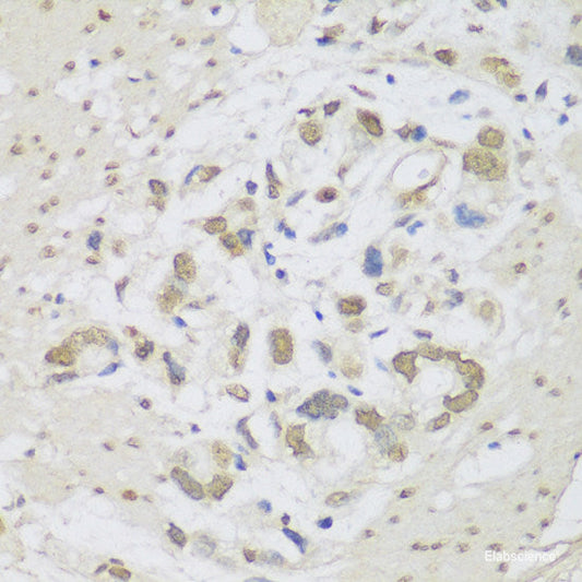 Western blot analysis of extracts of Rat brain using CD81 Polyclonal Antibody at dilution of 1:1000.
