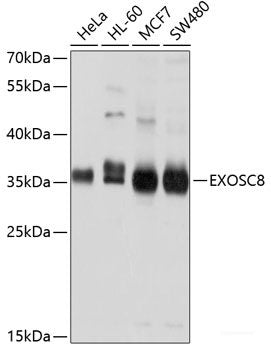 Immunohistochemistry of paraffin-embedded Human liver damage using S100A12 Polyclonal Antibody at dilution of  1:100 (40x lens).