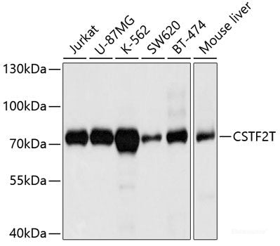 Immunohistochemistry of paraffin-embedded Human prostate using SLC4A4 / NBC Polyclonal Antibody at dilution of  1:100 (40x lens).