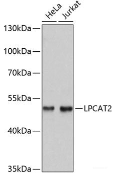Immunohistochemistry of paraffin-embedded Rat heart using TYROBP Polyclonal Antibody at dilution of  1:100 (40x lens).