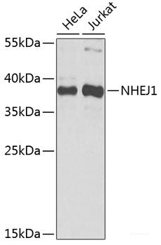 Immunohistochemistry of paraffin-embedded Rat brain using STXBP1 Polyclonal Antibody at dilution of  1:100 (40x lens).