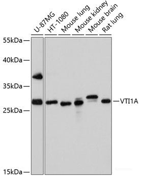 Immunohistochemistry of paraffin-embedded Human colon using PI3 Polyclonal Antibody at dilution of  1:100 (40x lens).
