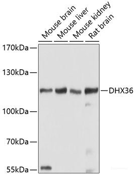 Immunohistochemistry of paraffin-embedded Human tonsil using HSD17B10 Polyclonal Antibody at dilution of  1:100 (40x lens).