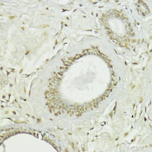 Immunofluorescence analysis of HeLa cells using CDC34 Polyclonal Antibody