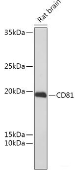 Immunohistochemistry of paraffin-embedded Rat brain using LBR Polyclonal Antibody at dilution of  1:200 (40x lens).
