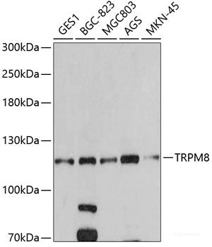 Immunofluorescence analysis of HeLa cells using PRDM14 Polyclonal Antibody at dilution of  1:100. Blue: DAPI for nuclear staining.