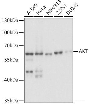 Immunohistochemistry of paraffin-embedded Human prostate using INSL3 Polyclonal Antibody at dilution of  1:100 (40x lens).