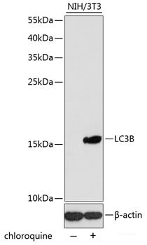 Immunofluorescence analysis of Human spleen using SLAMF7 Polyclonal Antibody at dilution of  1:100 (40x lens). Blue: DAPI for nuclear staining.