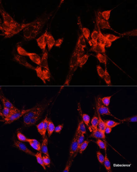 Immunohistochemistry of paraffin-embedded Rat brain using COG2 Polyclonal Antibody at dilution of  1:100 (40x lens).